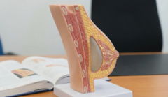 anatomical breast model cross section with teardrop implant placed submuscularly