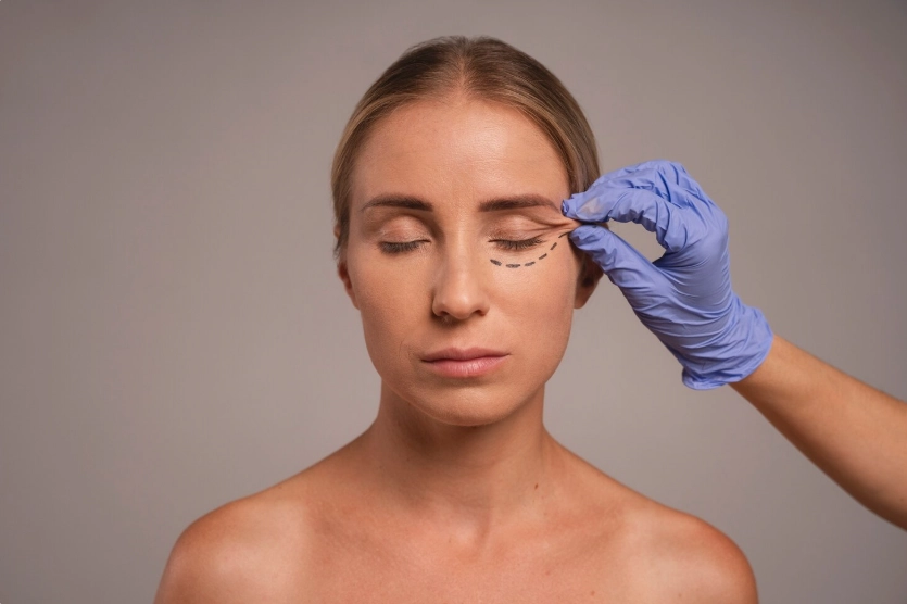fox eye lift