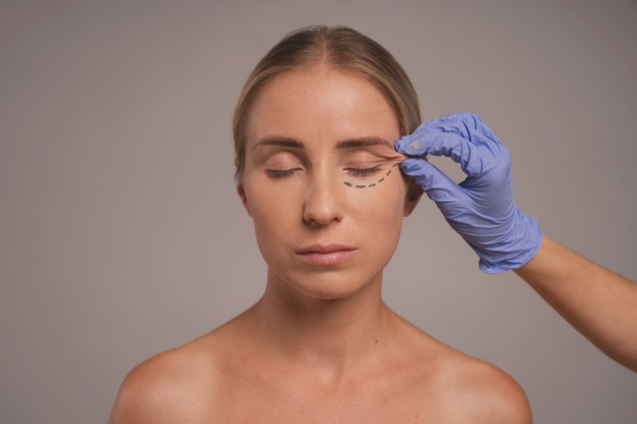 fox eye lift