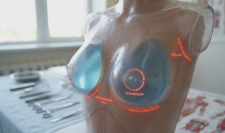 3d anatomical model breast implant scar locations
