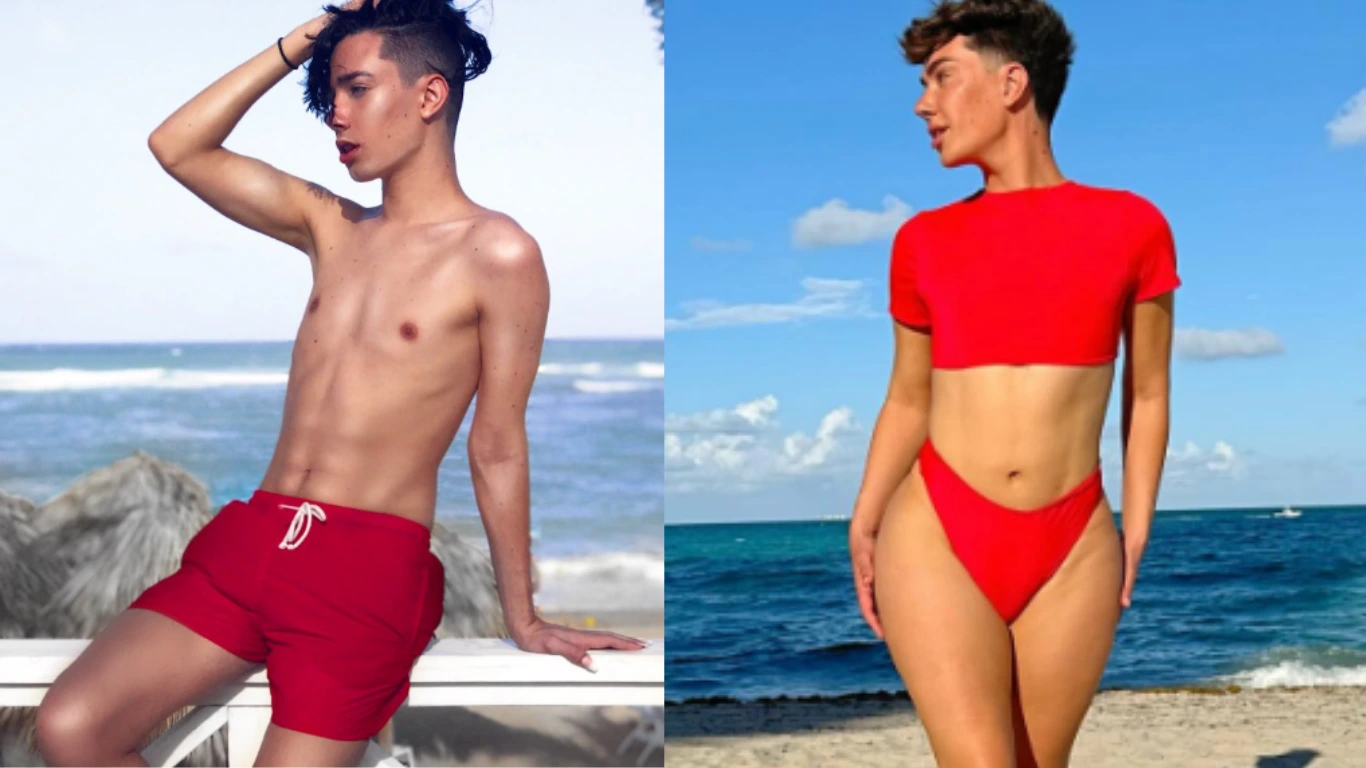 James Charles' BBL Surgery - Before and After