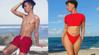 James Charles' BBL Surgery - Before and After
