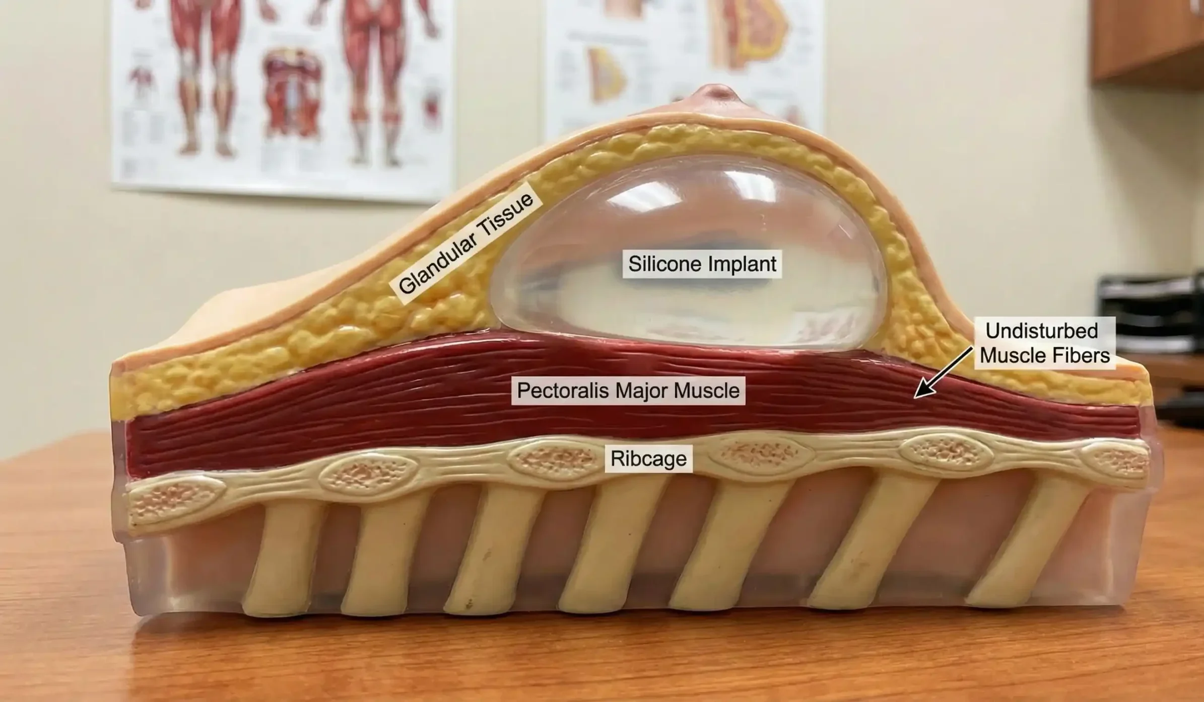 anatomical model undisturbed pectoral muscle