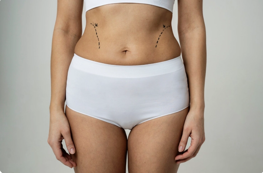 belly surgery