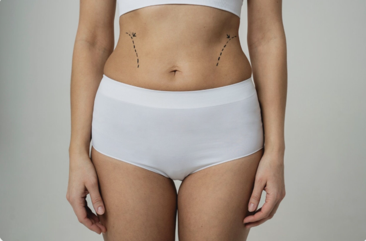 belly surgery