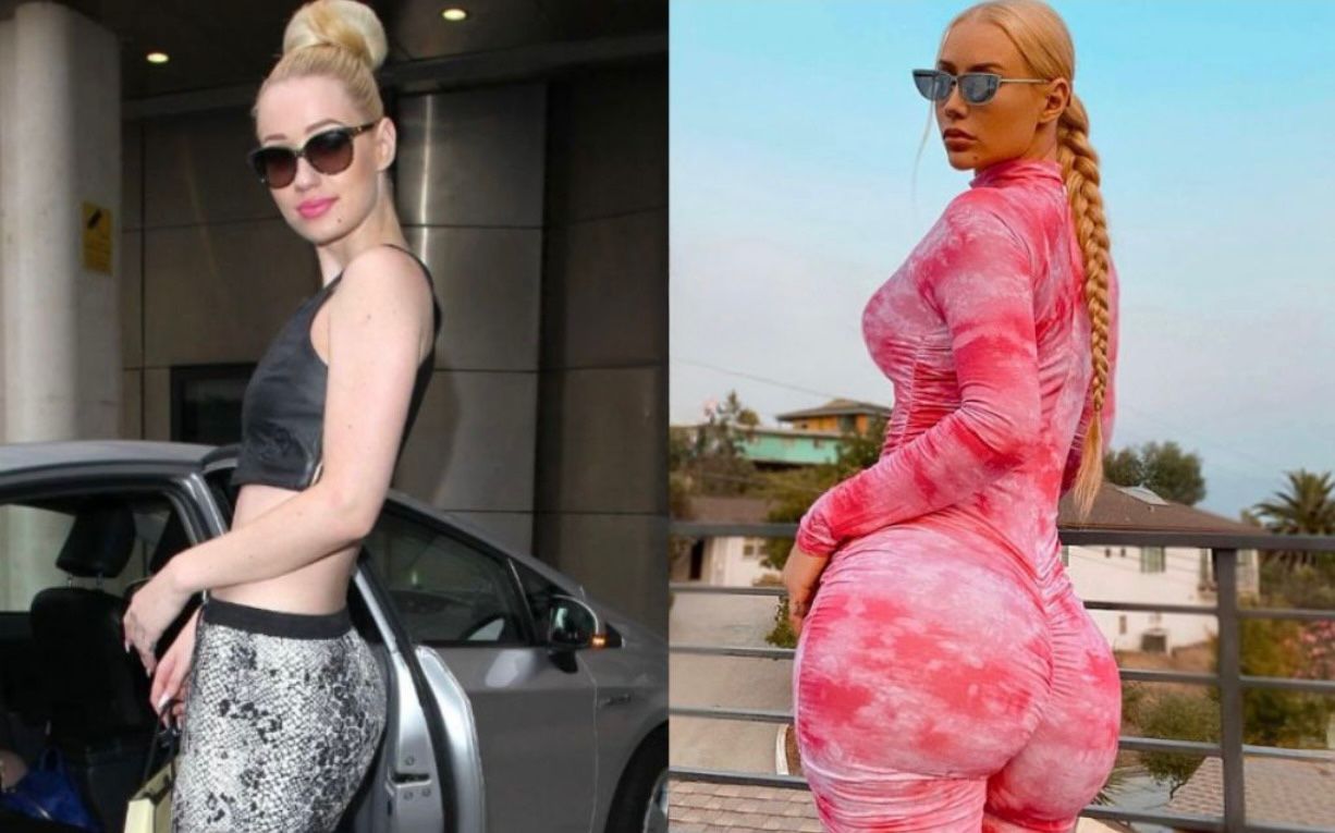 Operația BBL a Iggy Azalea: Înainte și după