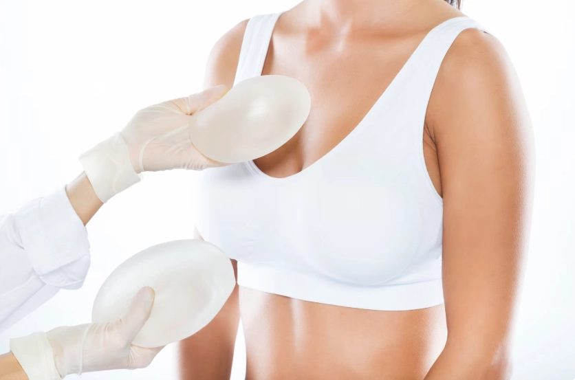 Mammoplasty: Results, Recovery, and Expectations