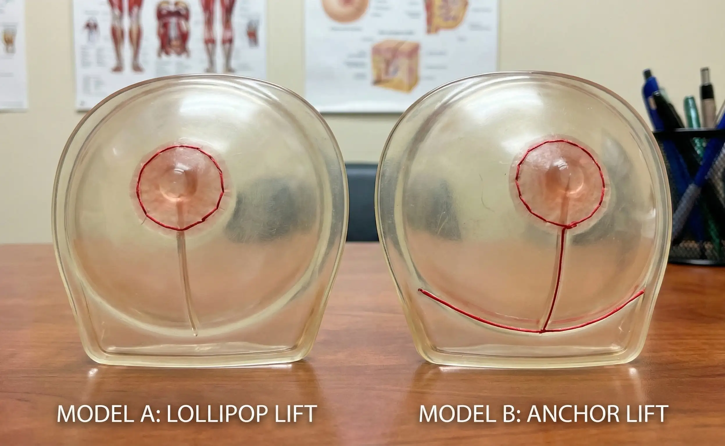 anatomical breast models lollipop vs anchor scars