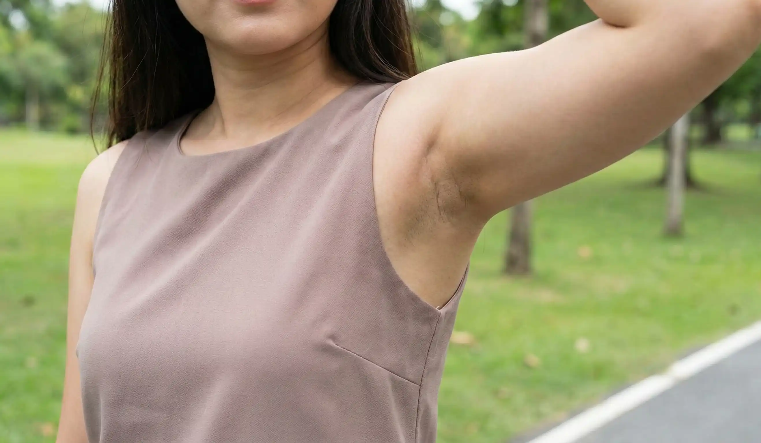 woman with axillary breast tissue bulge underarm park