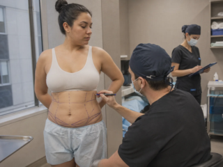360 liposuction surgery day