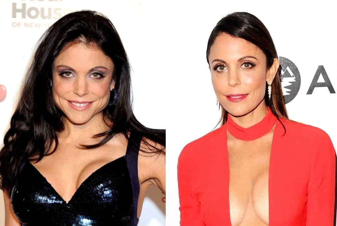 bethanny frankel breast