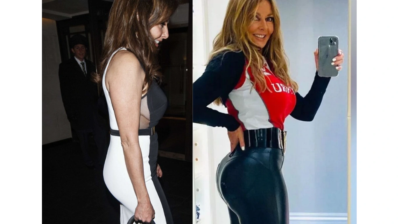 BBL a lui Carol Vorderman: Înainte și după