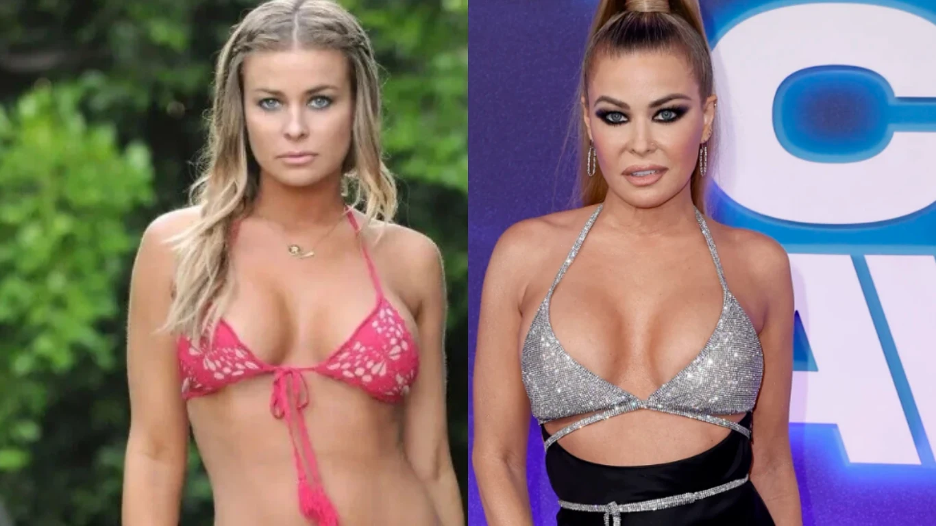 carmen electra before and after cover