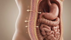 bariatric surgery