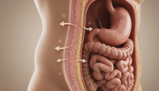 bariatric surgery