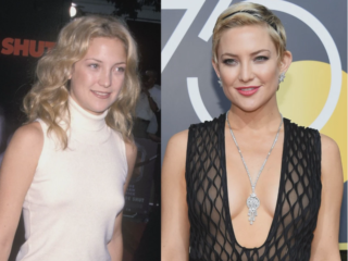 kate hudson breast implant before after