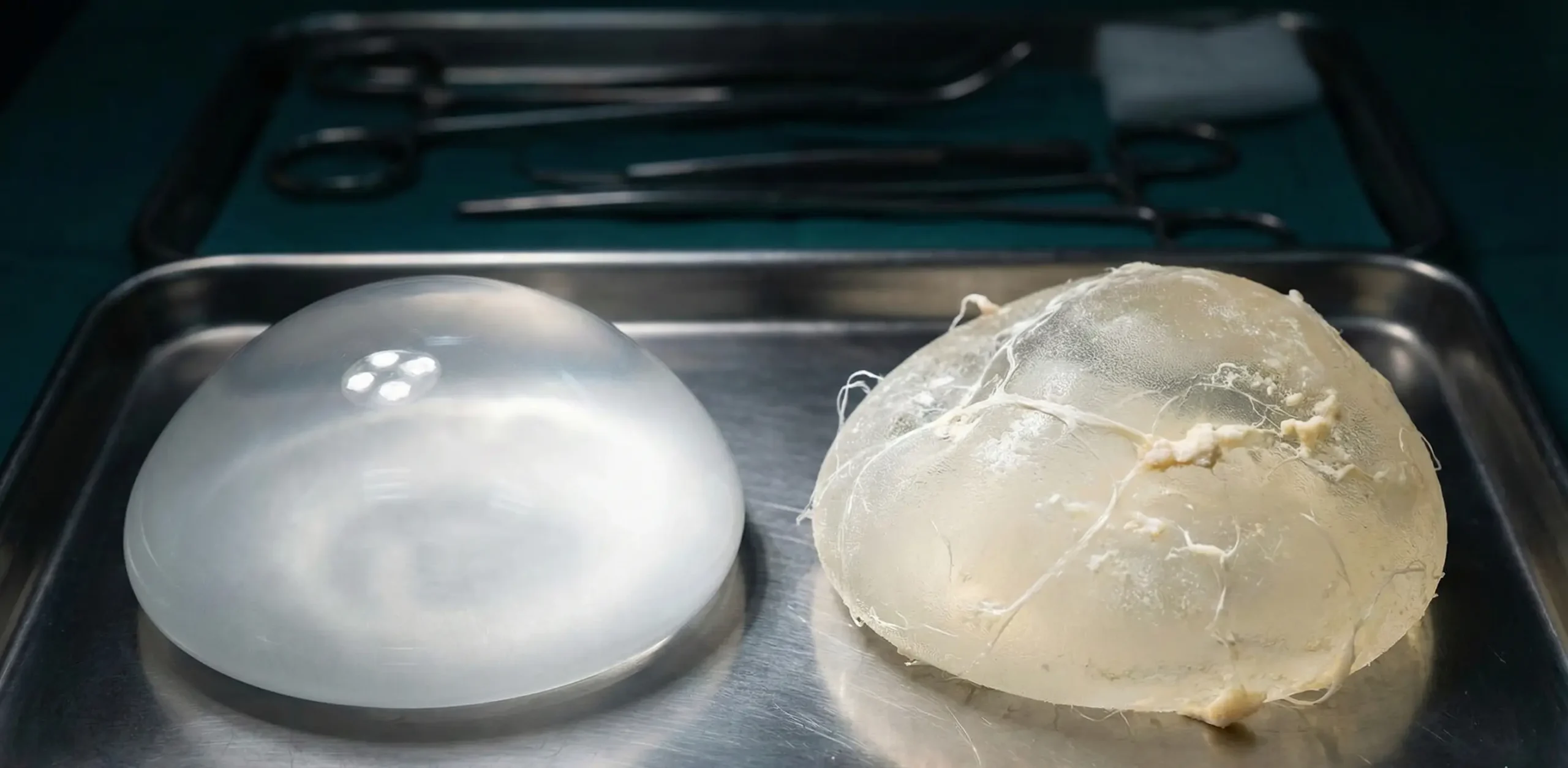 comparison of pristine new implant versus calcified explanted implant