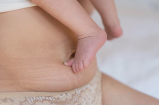 lipo after pregnancy
