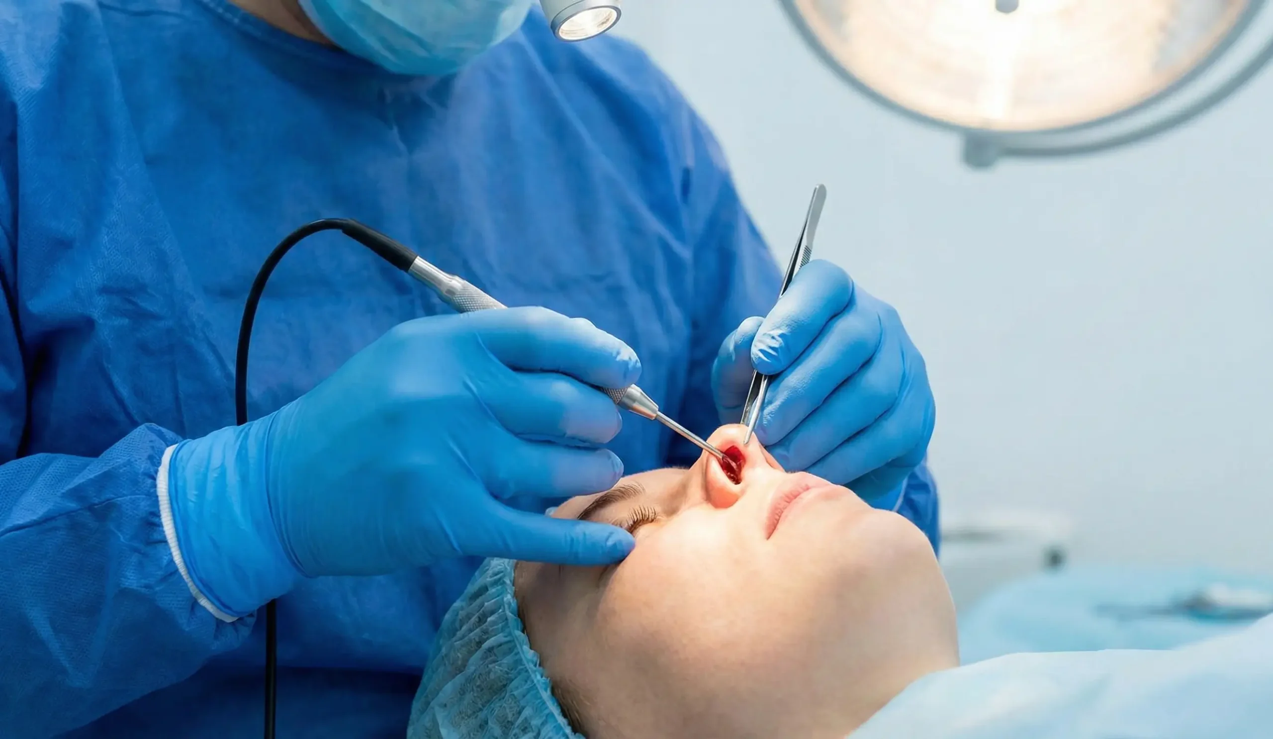 open rhinoplasty columellar incision surgical photo