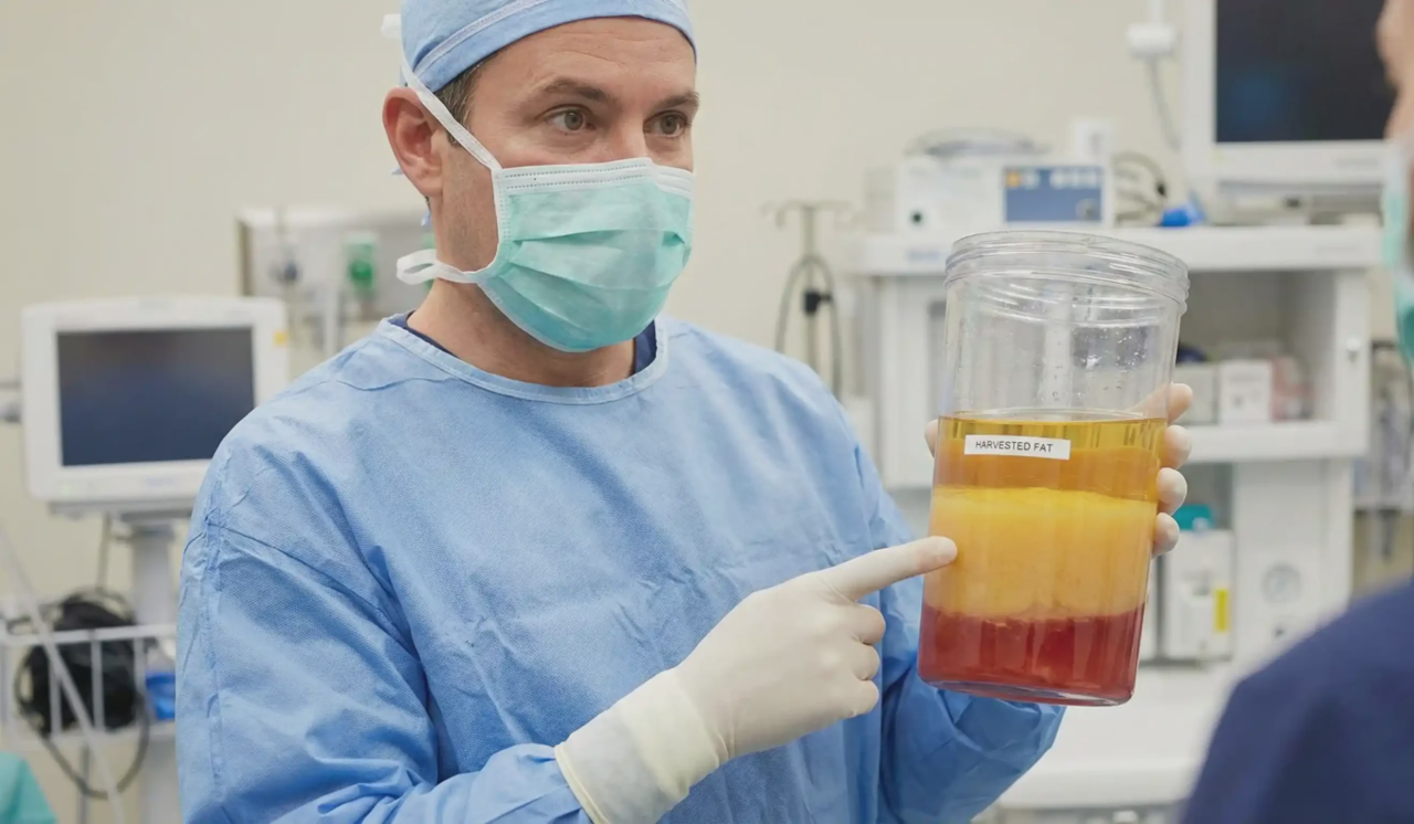 surgeon explaining harvested fat layers