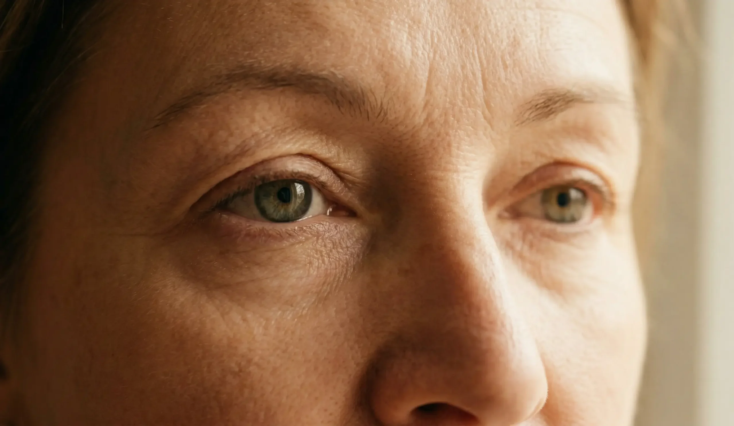 natural eyelid aging blepharoplasty