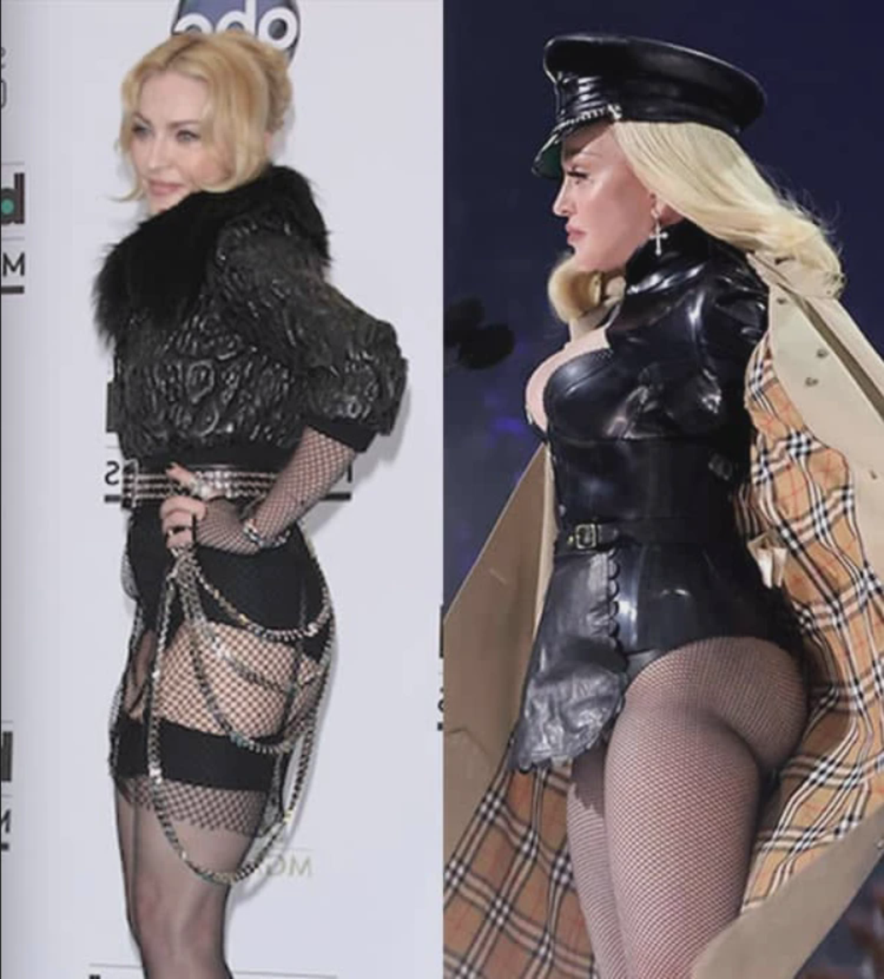 Madonna's BBL Transformation: Before and After