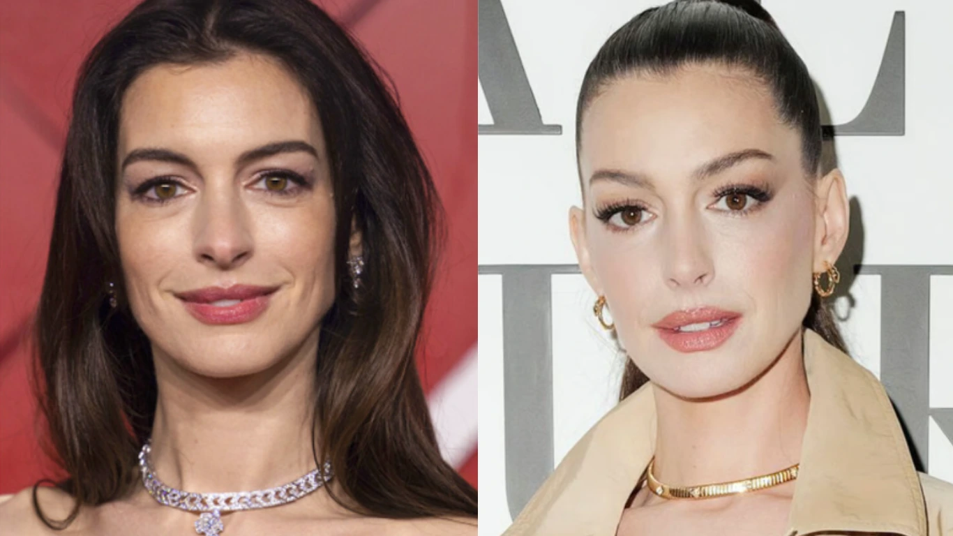 anne hathaway before and after