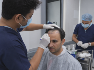 hair transplant procedure hairline design