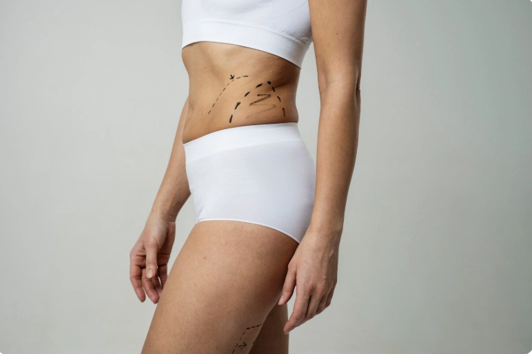Vaser Liposuction: Everything You Need to Know!