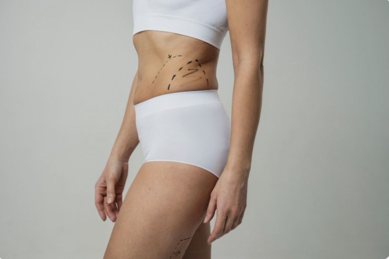 Vaser Liposuction: Everything You Need to Know!