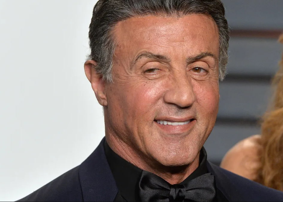 sylvester stallone after facelift