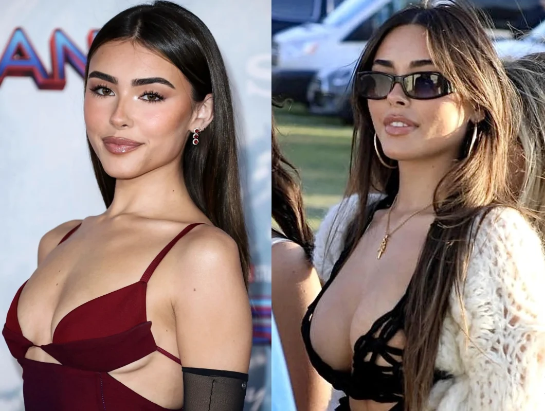 madison beer before after photos