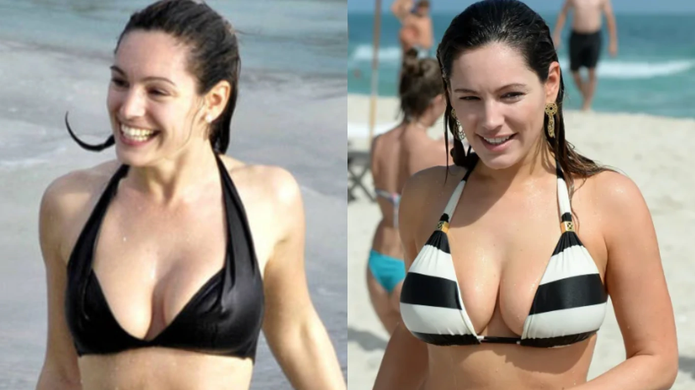 kelly brook before after
