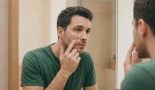 mole removal face safety patient reflection