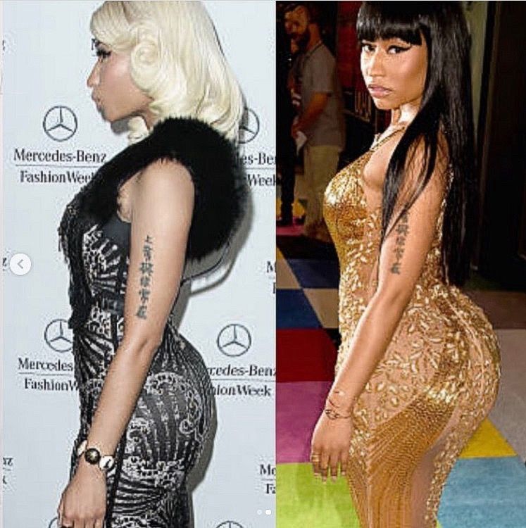 BBL-ul lui Nicki Minaj: Înainte și După