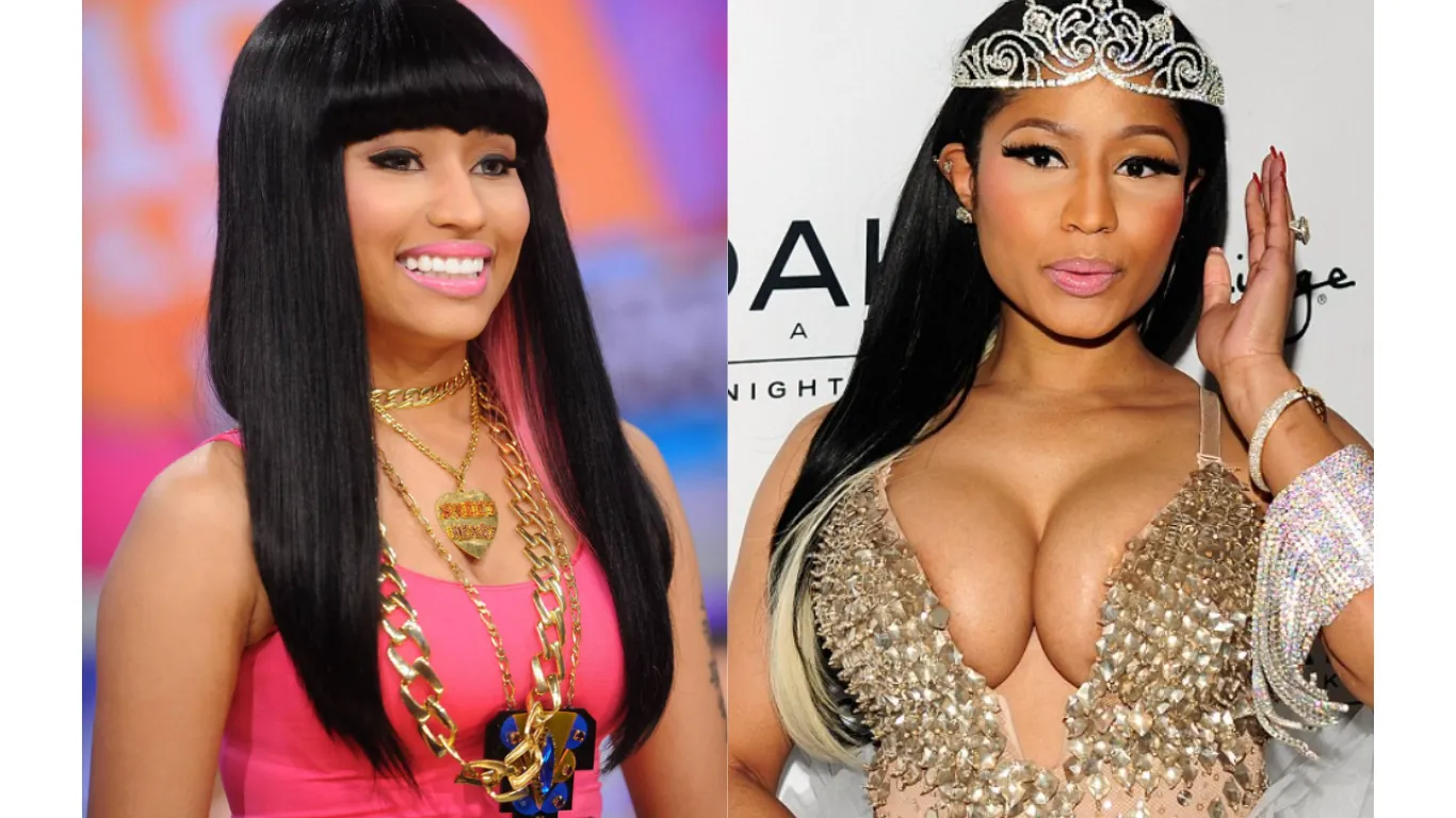 nicki minaj before and after