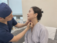 neck lift consultation before the surgery
