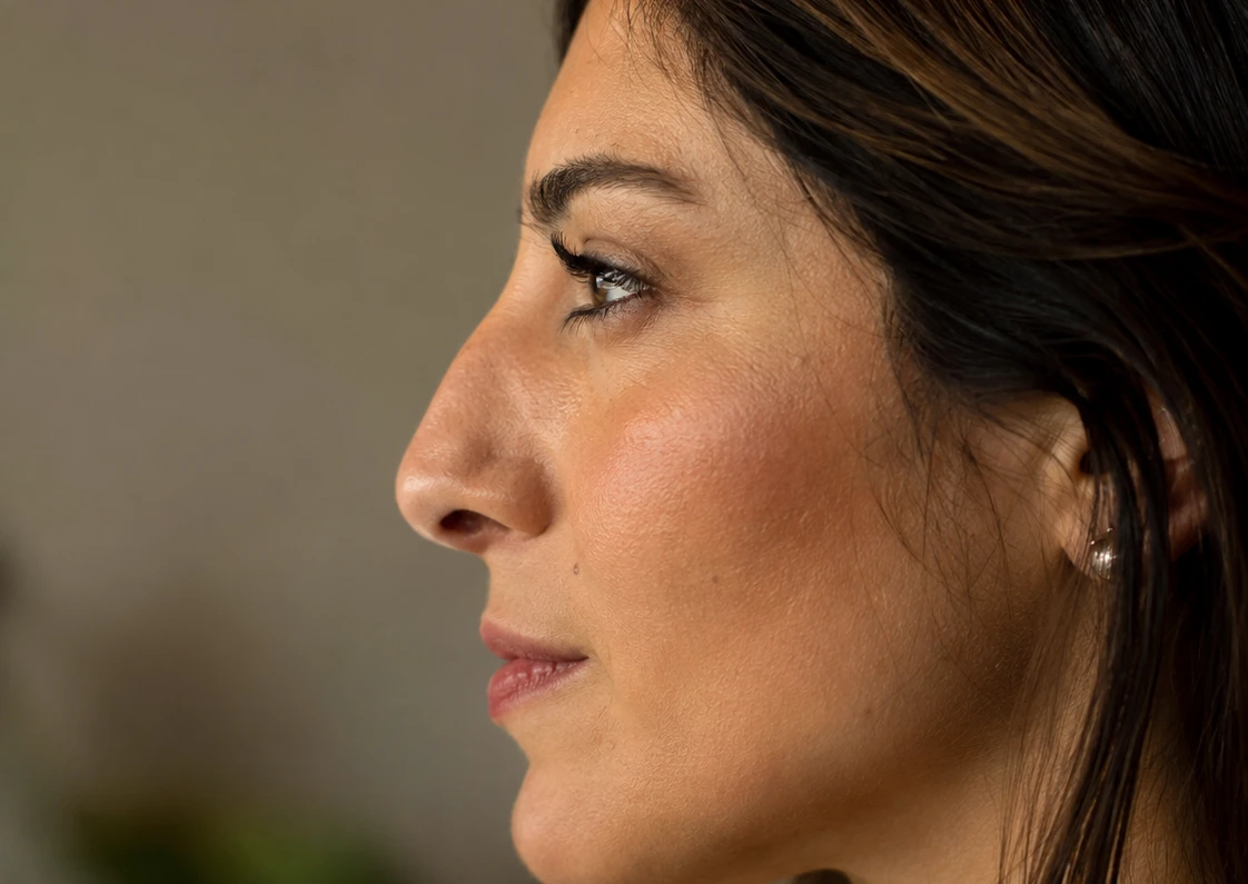 woman side profile nose bridge hump