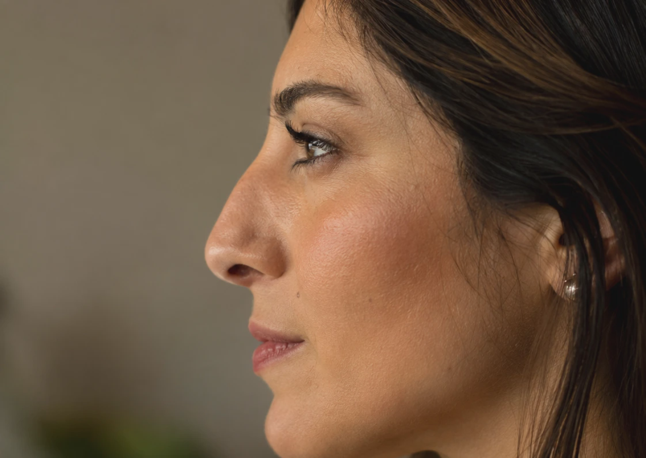 woman side profile nose bridge hump