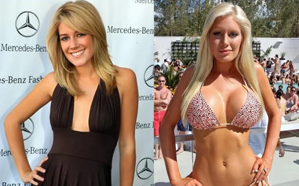 heidi montag before after cover