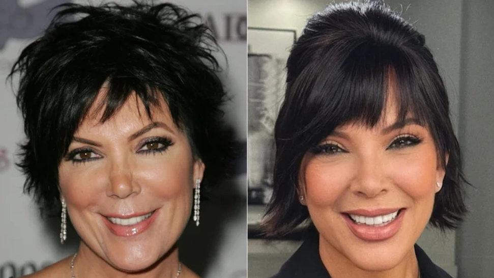 kris jenner face lift before after