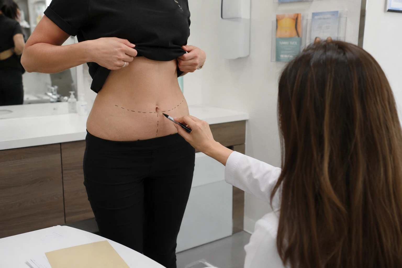 mini tummy tuck pre surgery marking
