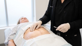 Do I Need Skin Removal Surgery After Weight Loss?