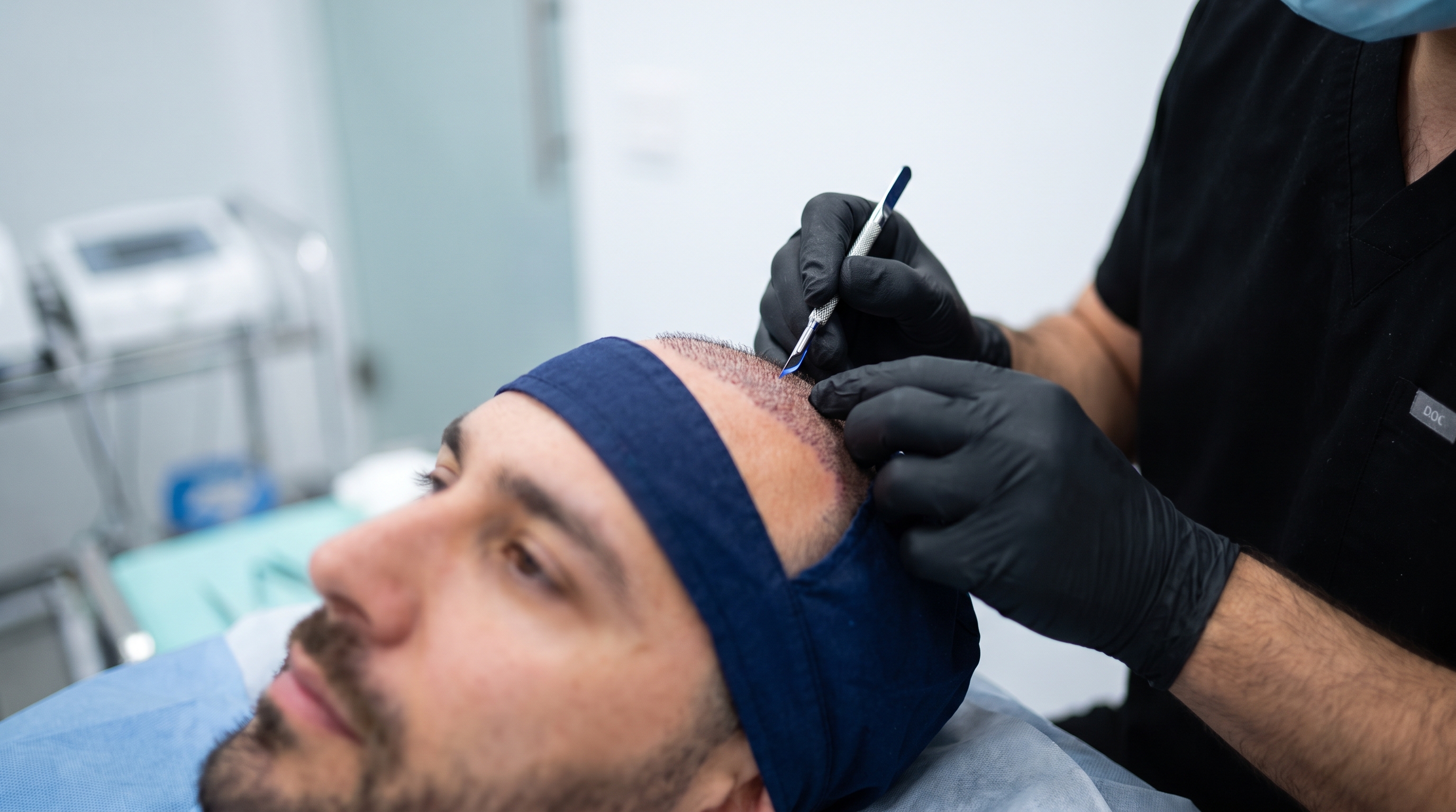 A sapphire blade creating a precise, wedge-shaped incision on the scalp during a hair transplant.